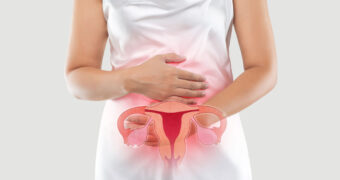 Schwangere Frau hat Endometriose.