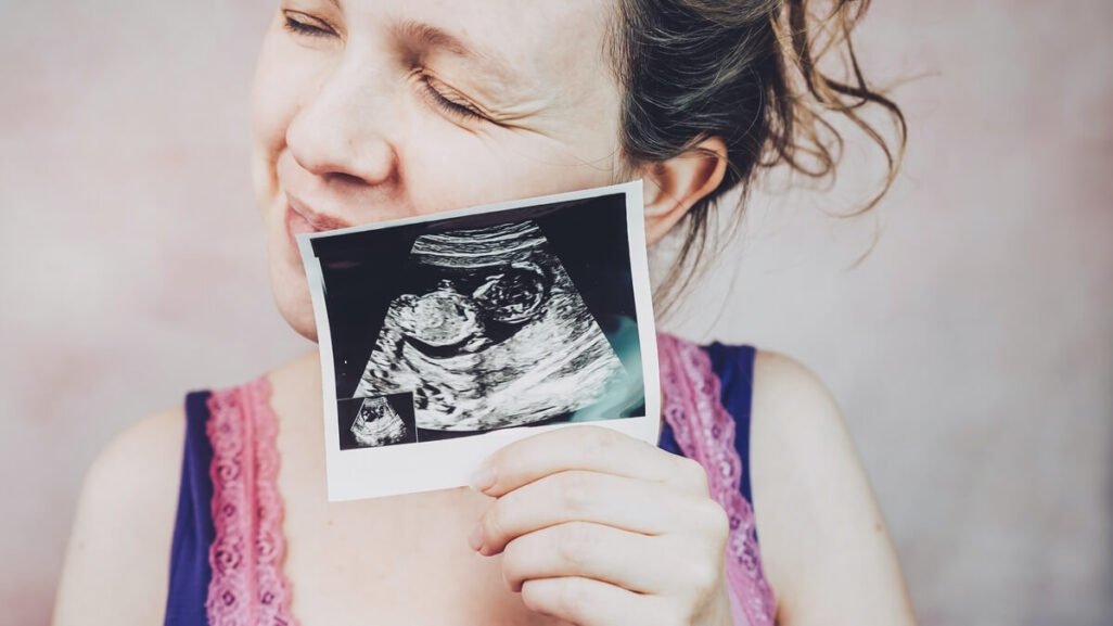 Frau herzt das Ultraschallbild ihres Babys